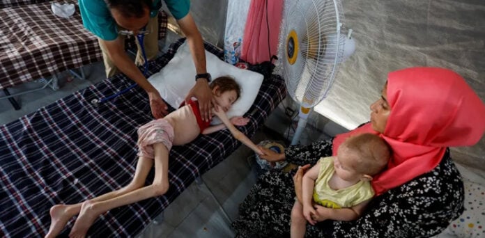 غزہ میں غذائی قلت کے باعث 66 بچے چل بسے