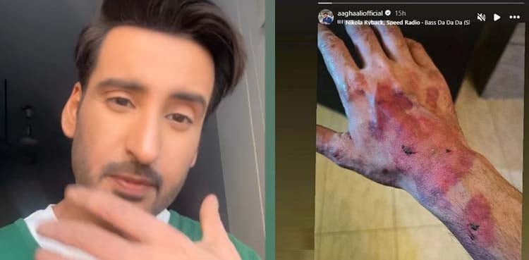 آغا علی ایکشن سین کے دوران زخمی ہوگئے