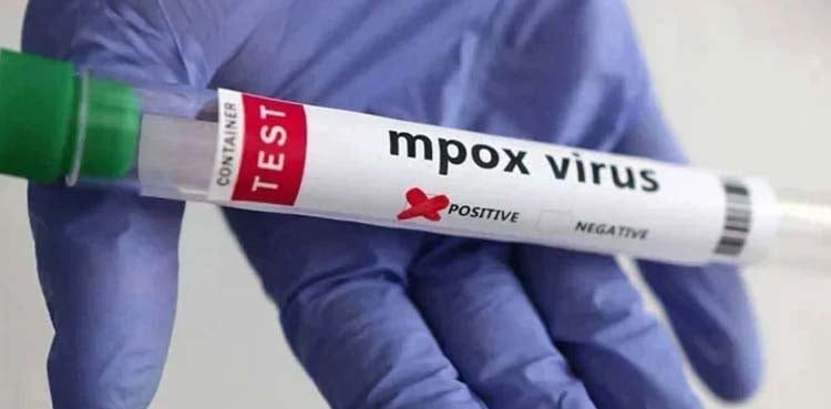 ایم پاکس کی صورت حال، محکمہ صحت نے اعدادوشمار جاری کردیے